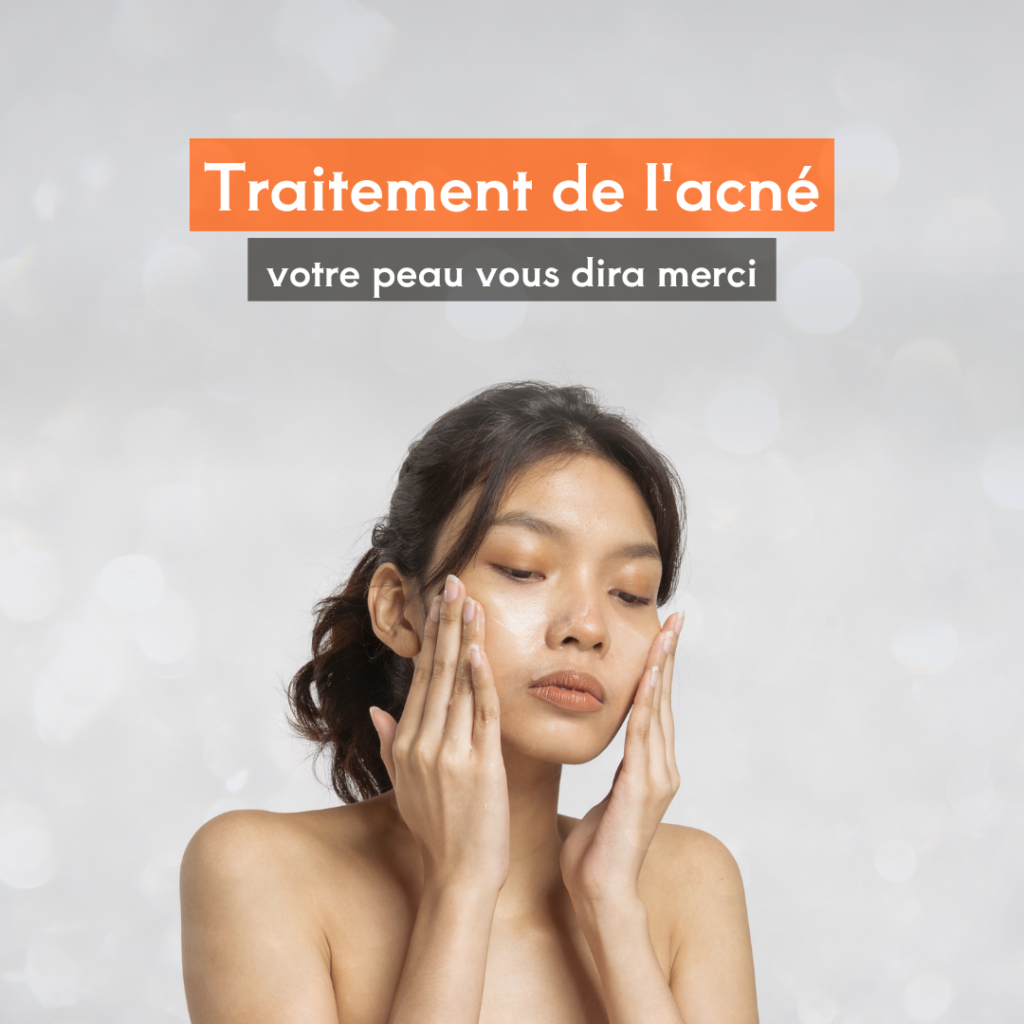 Comment J’ai Surmonté Mon Acné avec une Routine de Soin Coréenne (K-Beauty) en 3 Mois