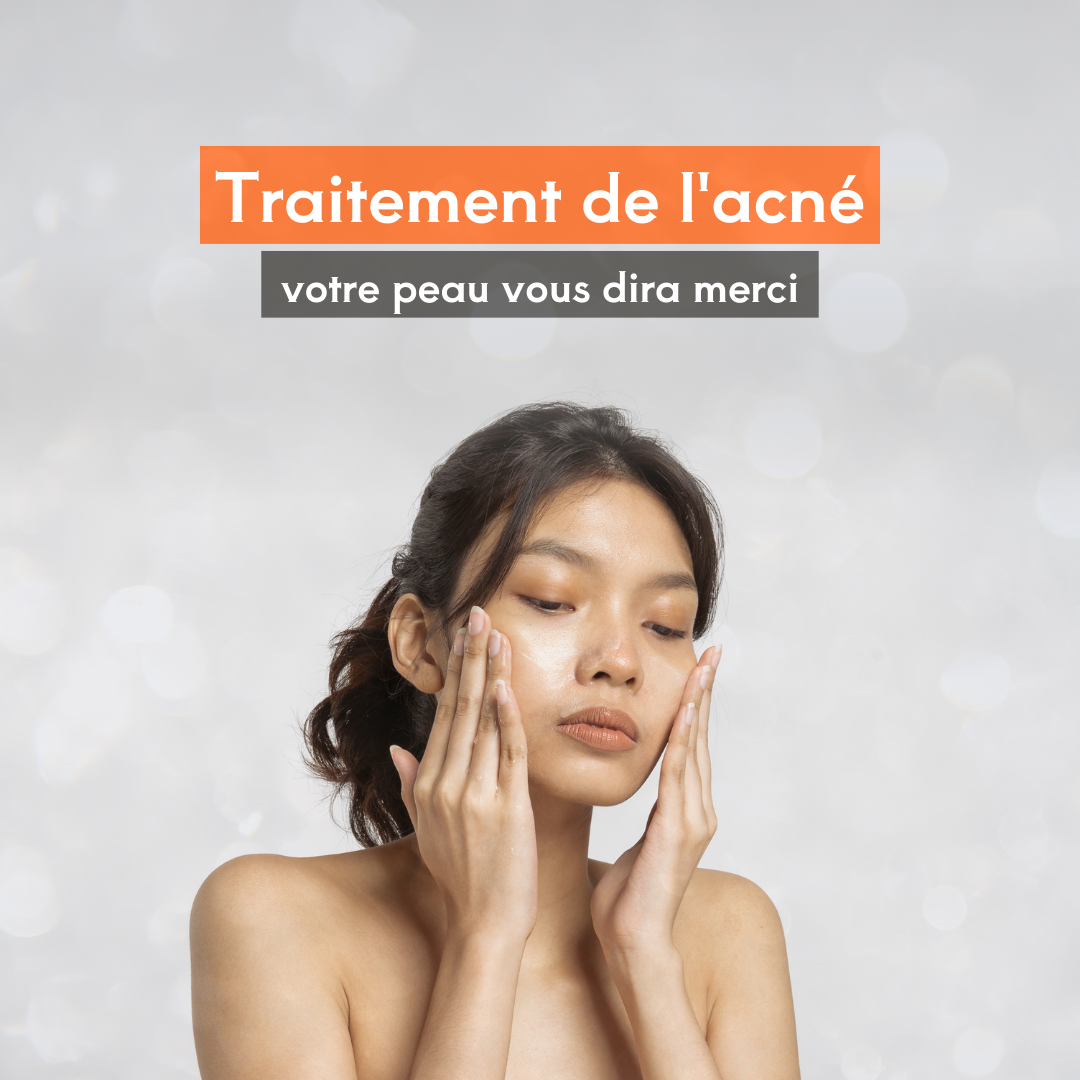 Comment J’ai Surmonté Mon Acné avec une Routine de Soin Coréenne (K-Beauty) en 3 Mois